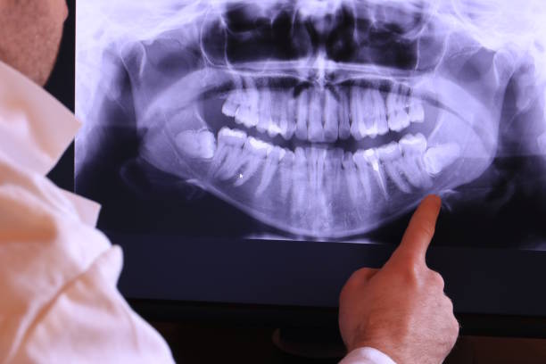 Best Broken or Chipped Tooth Repair in North Braddock, PA