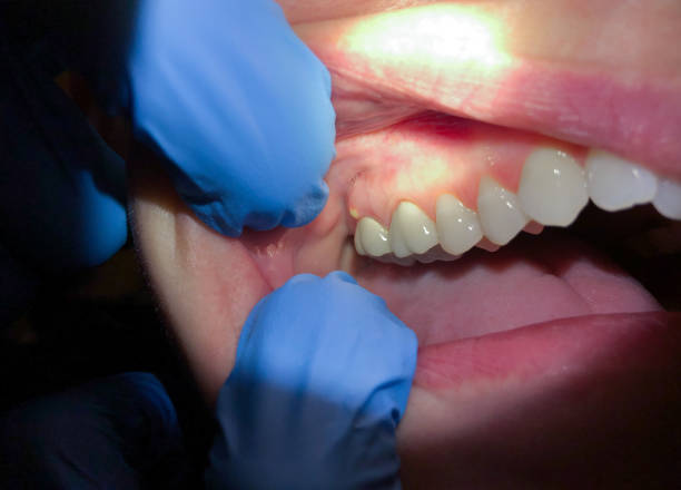 North Braddock, PA Emergency Dentist Pros