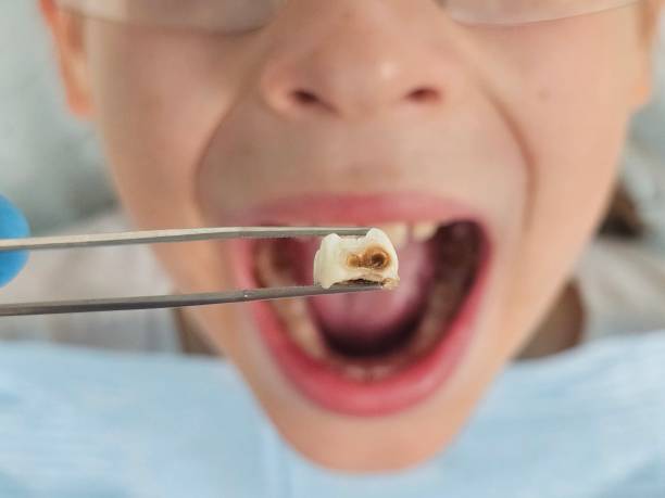 Best Weekend Emergency Dental Services in North Braddock, PA